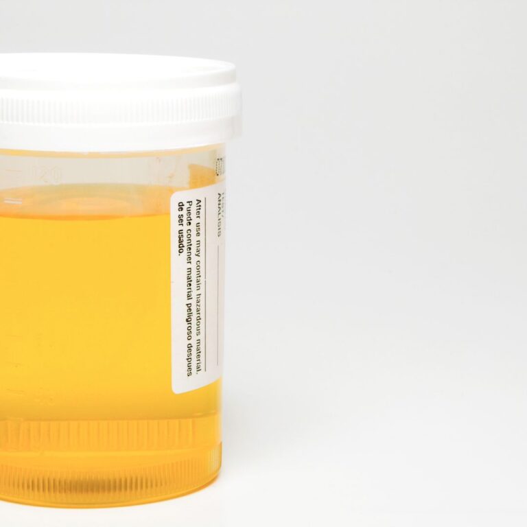 Urinarne infekcije kod žena: kompletan vodič kroz simptome, terapiju i prevenciju